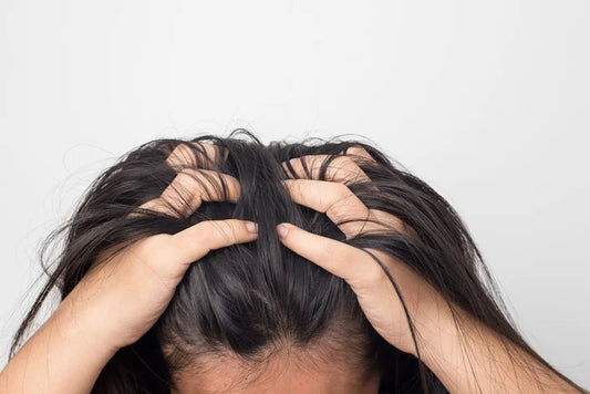 7 Ways To Treat & Prevent Dry Scalp in Winter